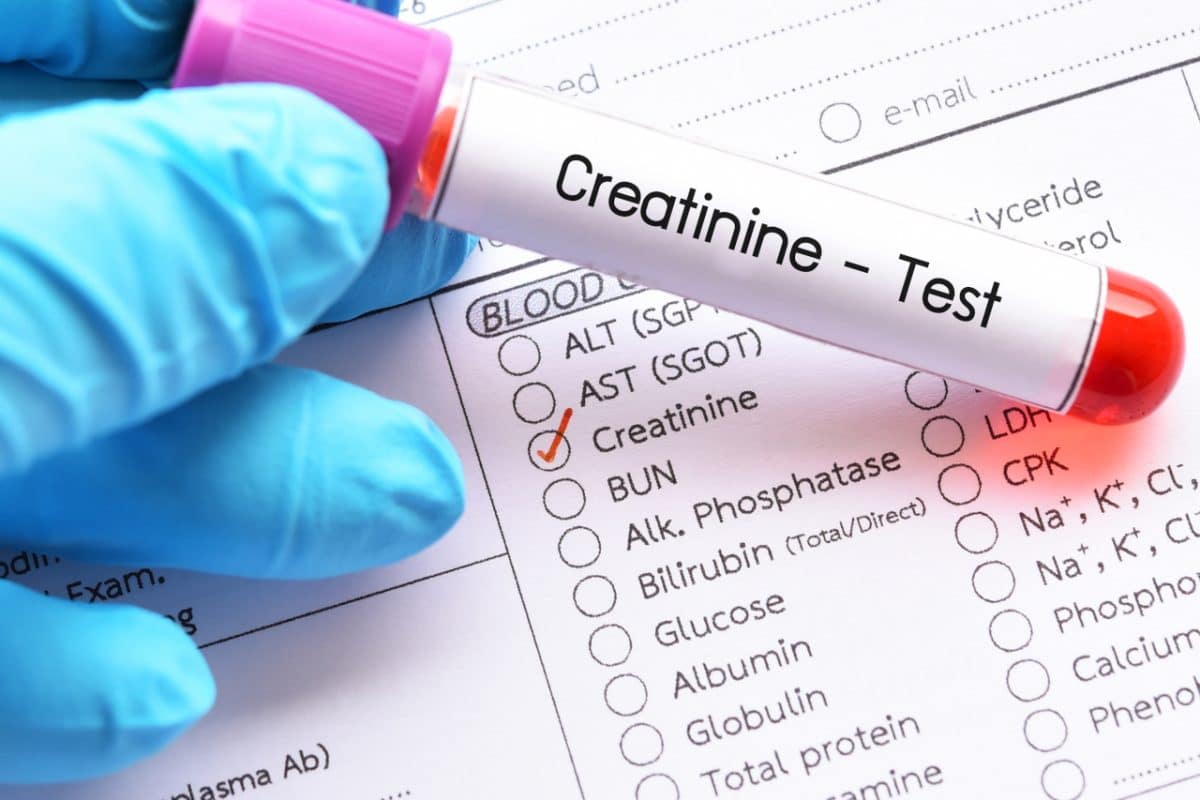 Creatinin, Creatin und Bedeutung des Creatininwerts Creatinin, Creatin und Bedeutung des Creatininwerts