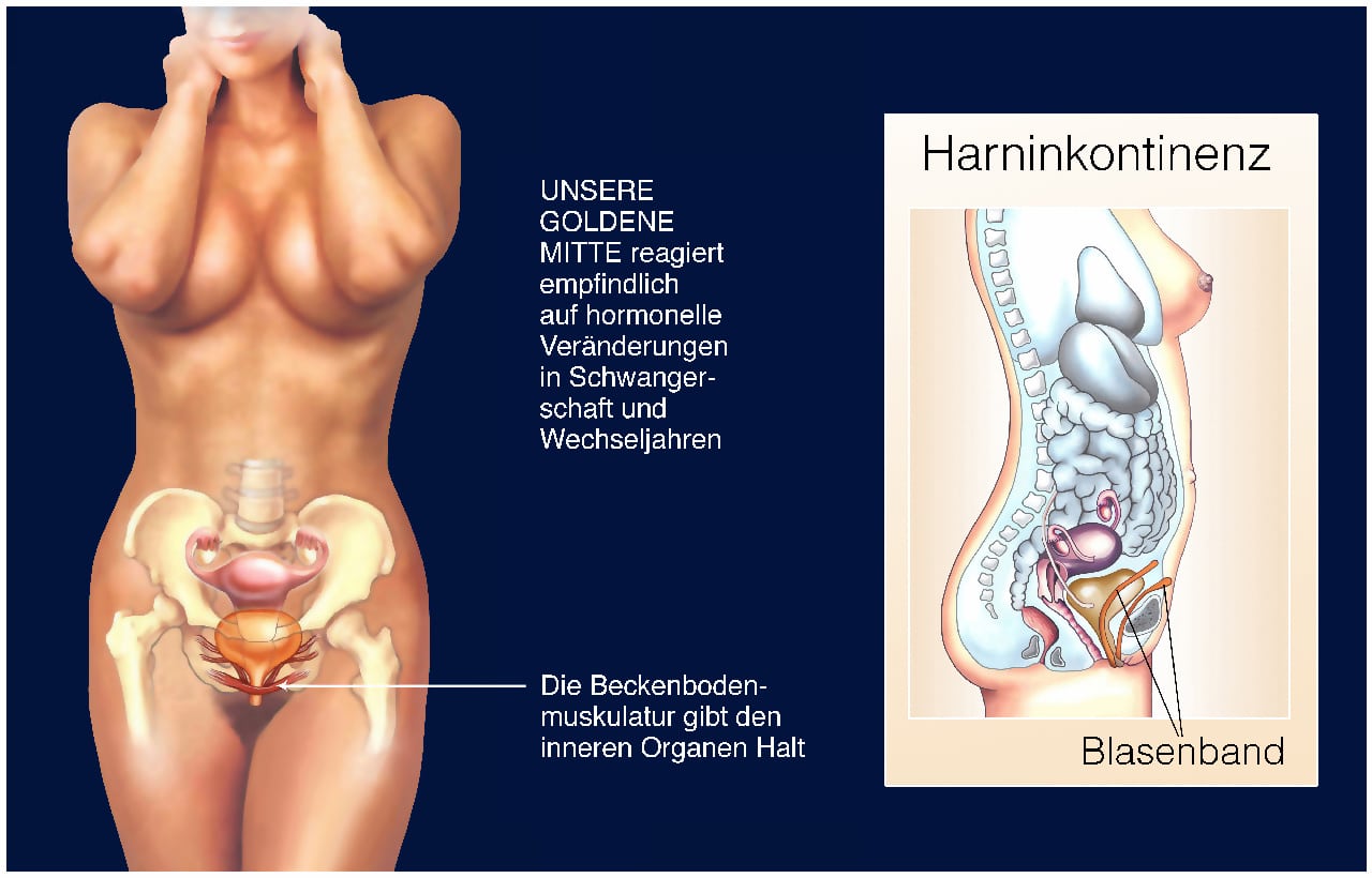 Harninkontinenz - Beckenboden und Blasenband